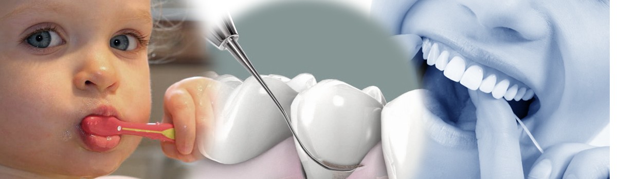 PERIODONCIA